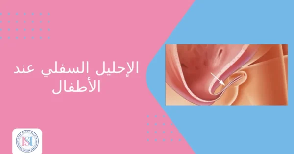 الإحليل السفلي عند الأطفال الإحليل السفلي عند الأطفال