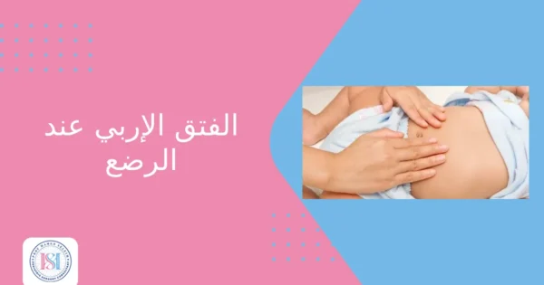 الفتق الإربي عند الرضع