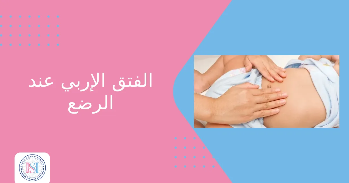 الفتق الإربي عند الرضع