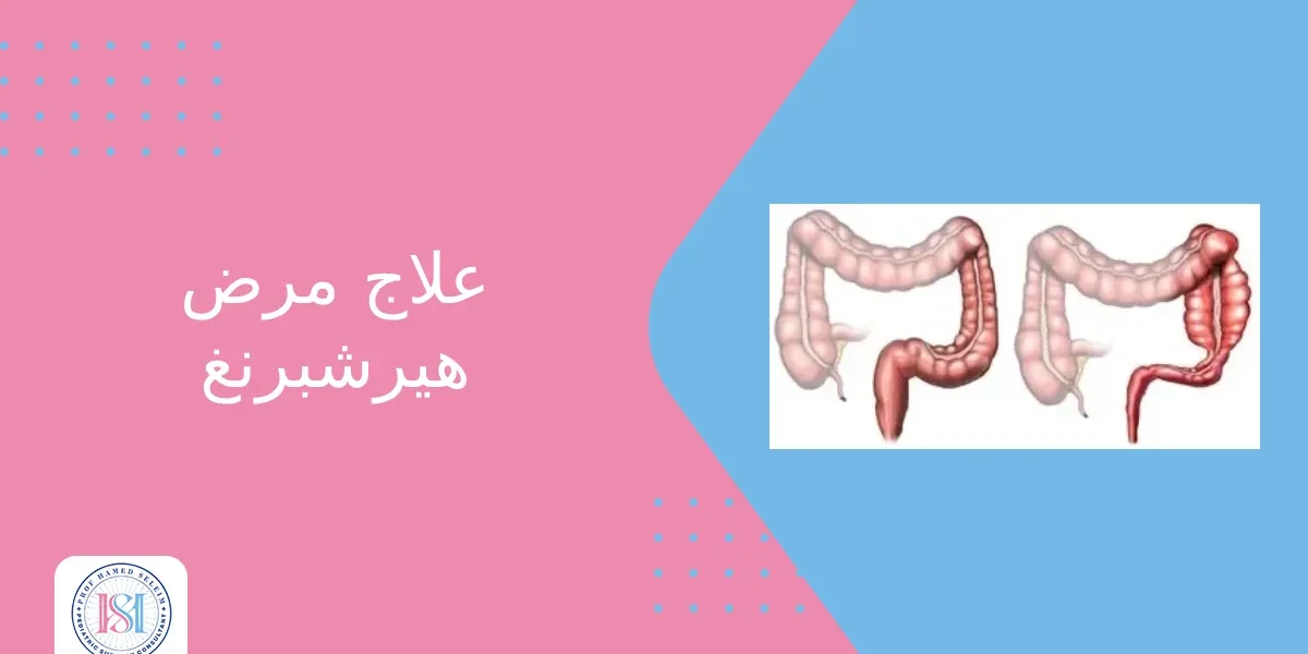 علاج مرض هيرشبرنغ علاج مرض هيرشبرنغ