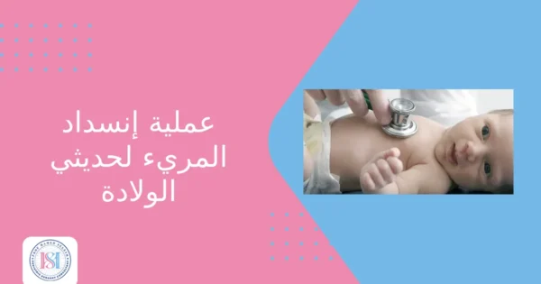عملية انسداد المريء لحديثي الولادة عملية انسداد المريء لحديثي الولادة