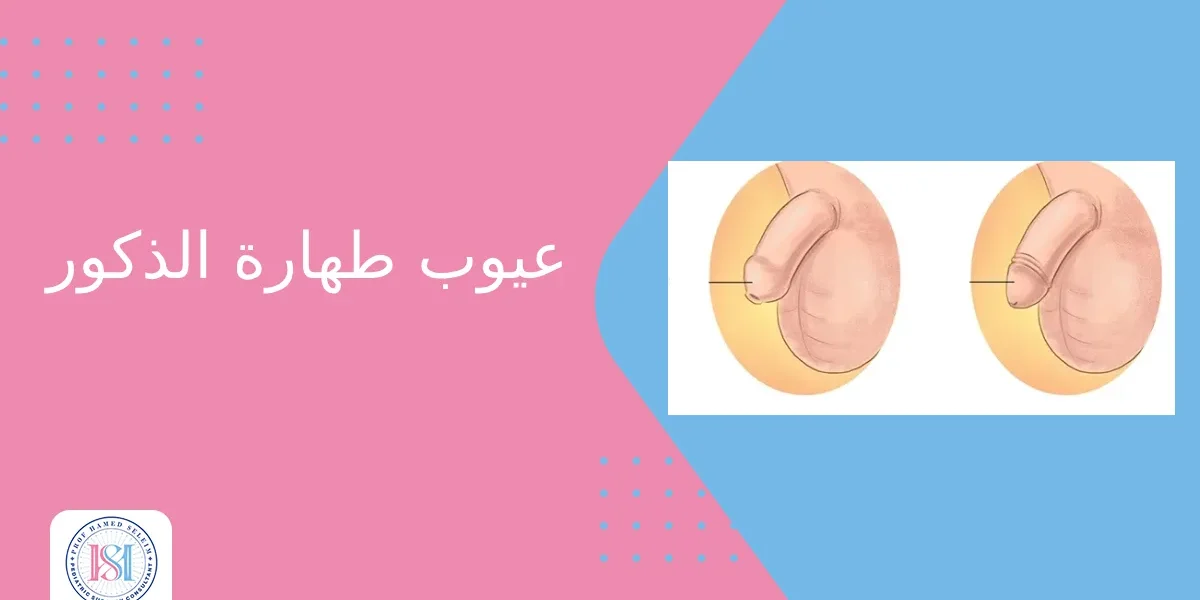 عيوب طهارة الذكور عيوب طهارة الذكور