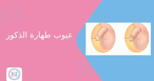 عيوب طهارة الذكور عيوب طهارة الذكور