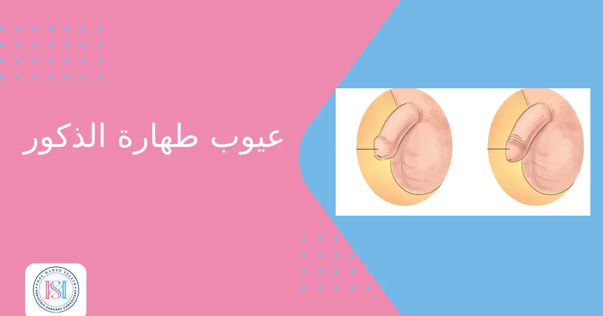 عيوب طهارة الذكور عيوب طهارة الذكور