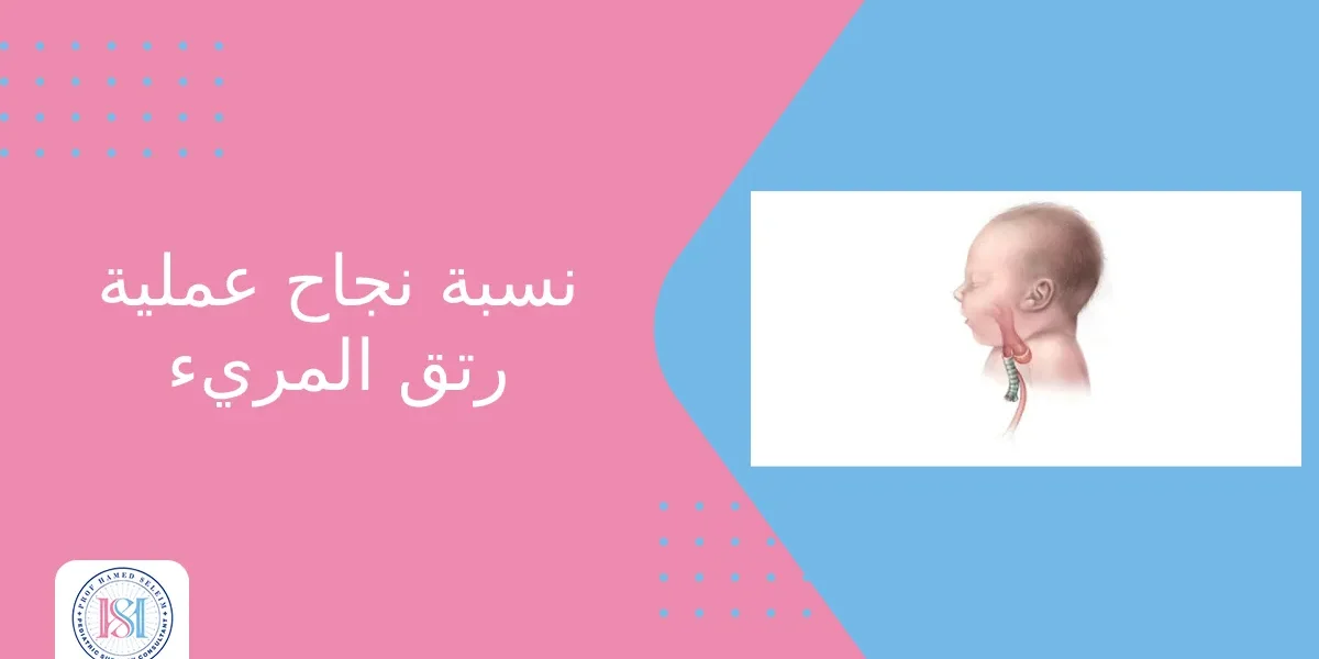 نسبة نجاح عملية رتق المريء