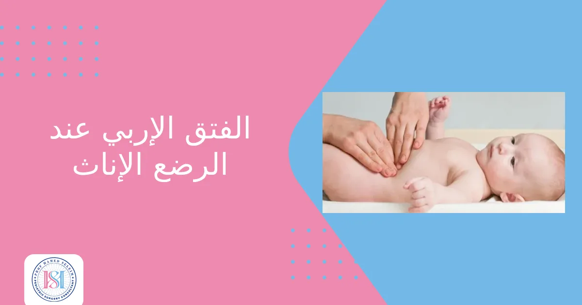 الفتق الإربي عند الرضع الإناث