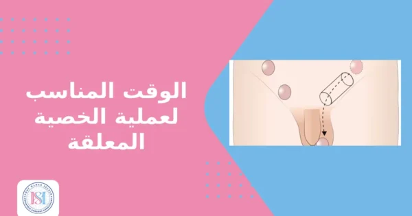 الوقت المناسب لعملية الخصية المعلقة الوقت المناسب لعملية الخصية المعلقة