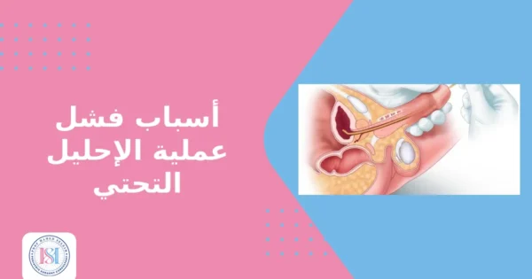 أسباب فشل عملية الإحليل التحتي