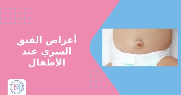 أعراض الفتق السري عند الأطفال