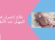علاج احمرار فتحة المهبل عند الأطفال