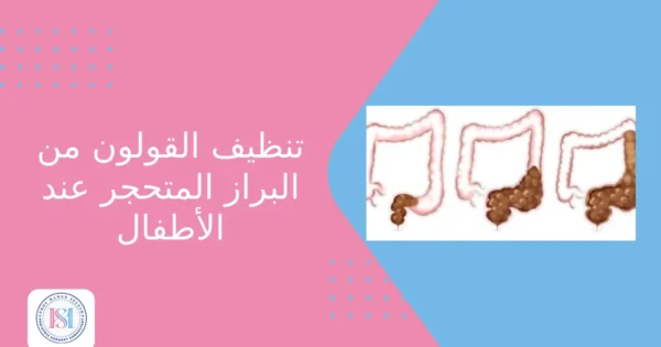 تنظيف القولون من البراز المتحجر عند الأطفال تنظيف القولون من البراز المتحجر عند الأطفال