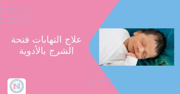 علاج التهابات فتحة الشرج بالأدوية علاج التهابات فتحة الشرج بالأدوية