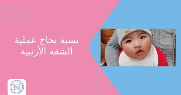 نسبة نجاح عملية الشفة الأرنبية