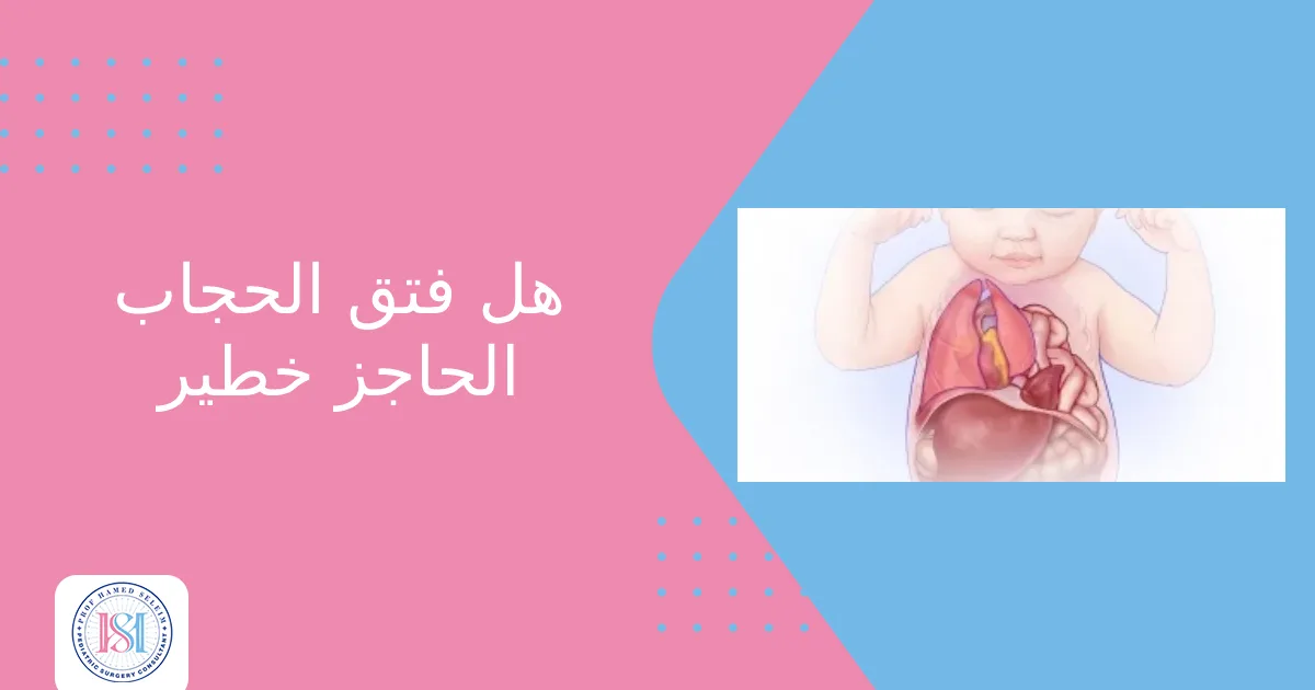 هل فتق الحجاب الحاجز خطير هل فتق الحجاب الحاجز خطير