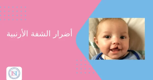 أضرار الشفة الأرنبية