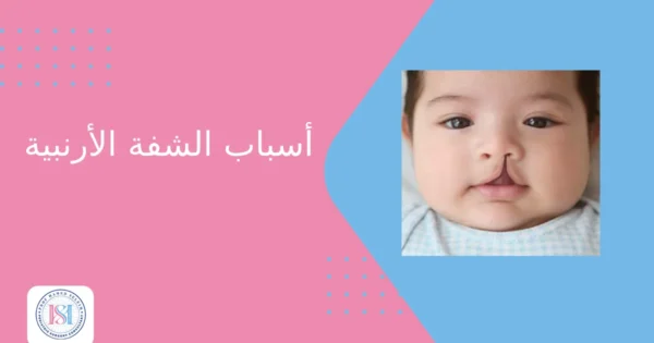 اسباب الشفة الأرنبية