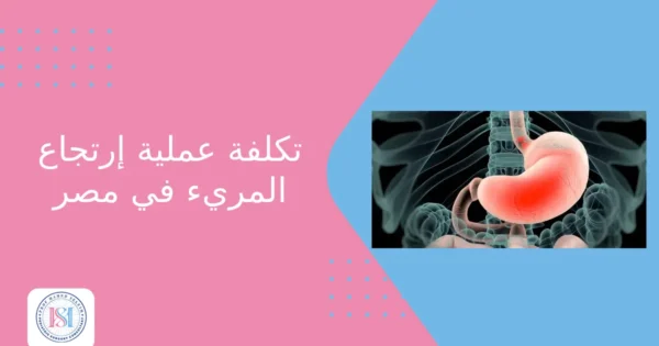 تكلفة عملية ارتجاع المريء في مصر تكلفة عملية ارتجاع المريء في مصر