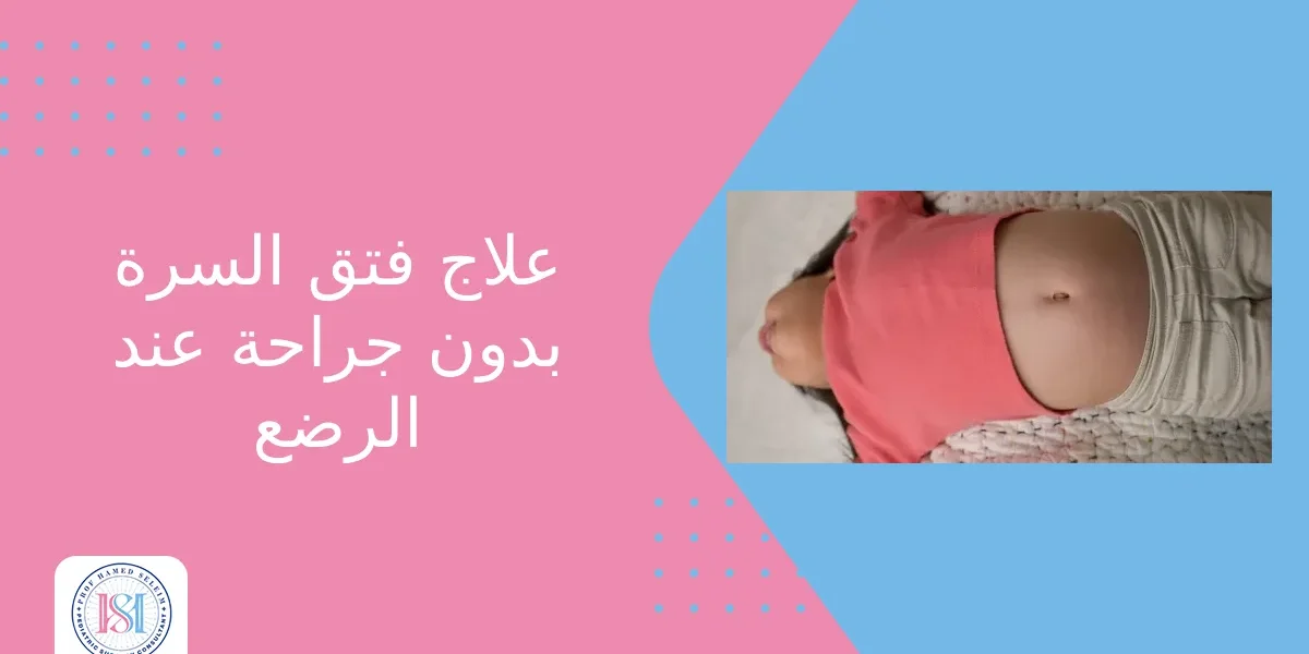 علاج فتق السرة بدون جراحة عند الرضع