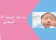 ما بعد عملية الإحليل السفلي