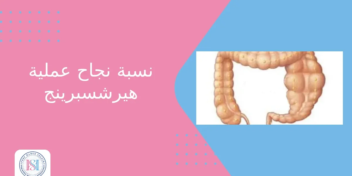 نسبة نجاح عملية هيرشسبرينج نسبة نجاح عملية هيرشسبرينج