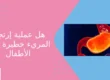 هل عملية ارتجاع المريء خطيرة على الأطفال