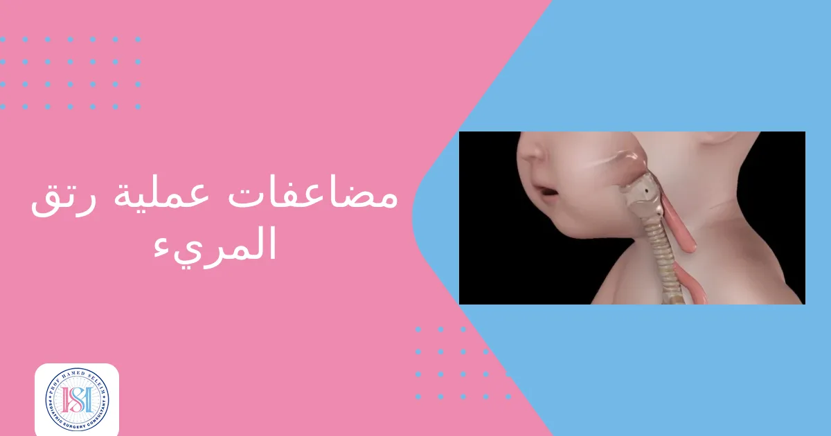 مضاعفات عملية رتق المريء