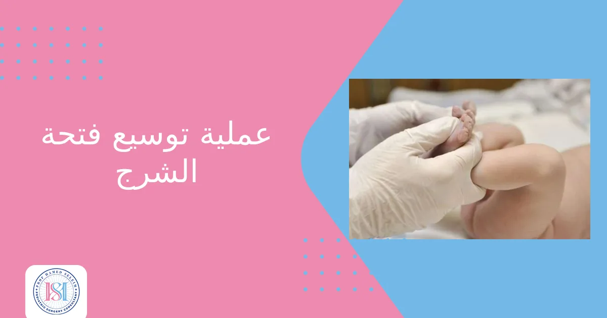 عملية توسيع فتحة الشرج